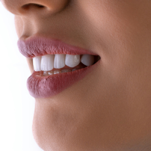 Acercamiento de una sontisa con dientes muy blancos y parejos, imagen recortada